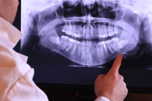 Best Broken or Cracked Tooth Emergency Dentist in Norton Center, MA